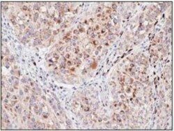 Rabbit anti-PMEL17/SILV, Clone: P14-V, Novus Biologicals:Antibodies:Primary